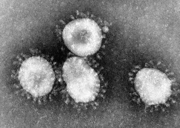 Il coronavirus e lo spettro della Sars