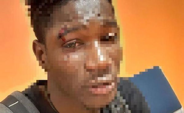 Palermo, aggressione razzista nei confronti di un ragazzo originario del Senegal