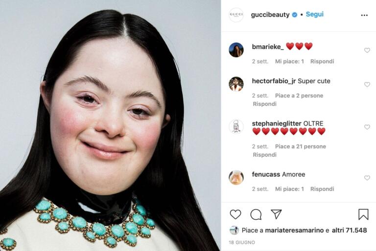 Monica Napoli evidenzia la pochezza dei commenti alla foto della modella di Gucci con sindrome di Down
