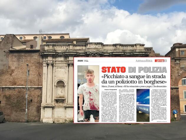 La denuncia di un ragazzo romano: «Ridotto così da un poliziotto in borghese» article-post