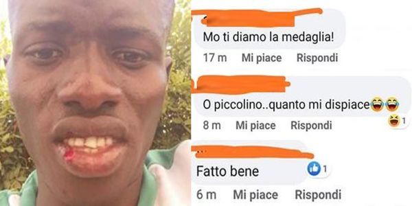 I vergognosi commenti alla notizia dell’aggressione al ragazzo di colore sulla spiaggia di Grosseto I vergognosi commenti alla notizia dell’aggressione al ragazzo di colore sulla spiaggia di Grosseto