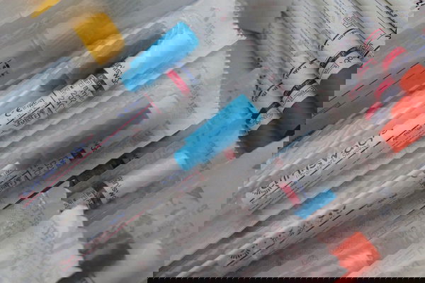 «Tamponi dai veterinari? Perché non dagli estetisti o massaggiatori»