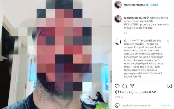 Sono passate due ore e Instagram ancora non ha rimosso Fabrizio Corona coperto di sangue