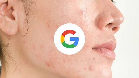 Lo strumento di Google che, tramite l’AI, permette di verificare la salute della pelle article-post