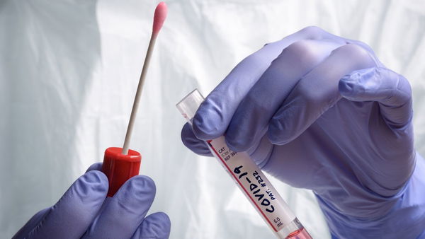 Google chiede ai dipendenti di fare un molecolare a settimana