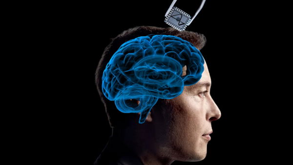 La storia di Neuralink: dal ruolo di Elon Musk agli insuccessi di una startup di successo