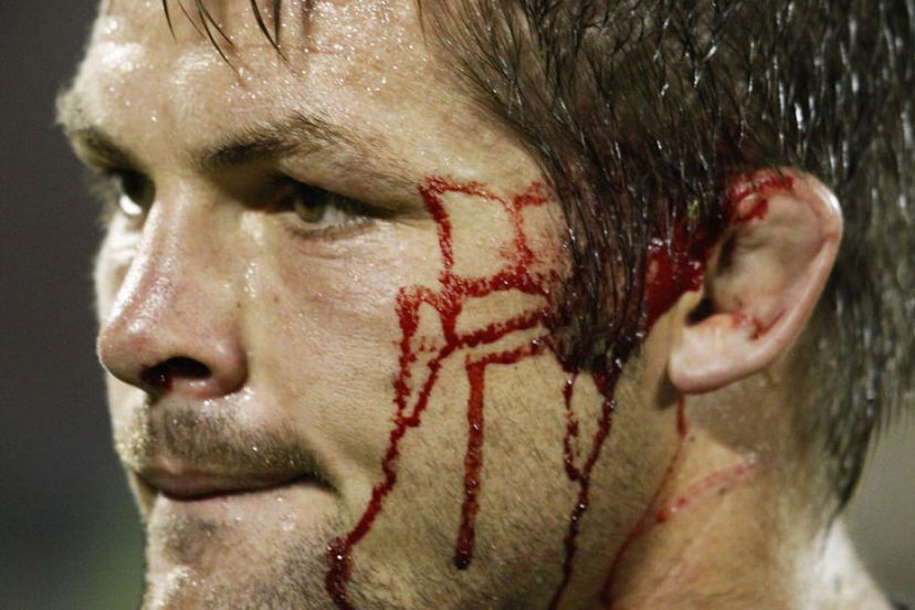 McCaw o Cuadrado? preview