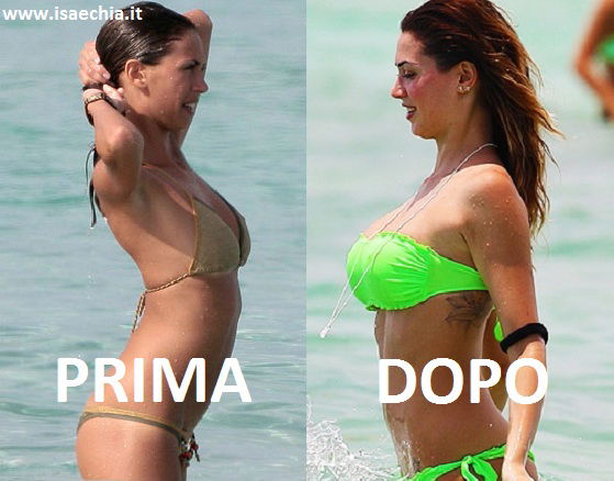 Melissa Satta si è rifatta il seno? preview