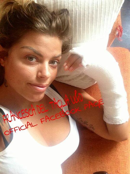 Francesca Del Taglia si è operata alla mano. Da Facebook una nuova foto ed alcuni vecchi scatti insieme ad Eugenio Colombo… preview