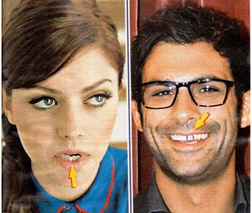 Annalisa Scarrone, Francesco Arca, Stefano De Martino e Pierdavide Carone: i denti rovinati macchiano i loro sorrisi article-post