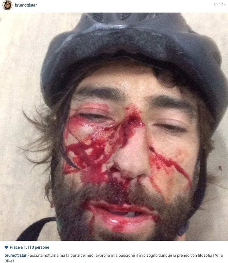 Grave incidente in bici per Vittorio Brumotti: ecco la foto che ha fatto preoccupare i fan