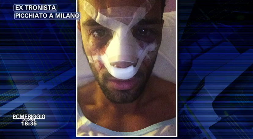 Alessio Lo Passo ospite a Pomeriggio Cinque: “Mi hanno picchiato in quattro, ho avuto paura per Roberta!” preview