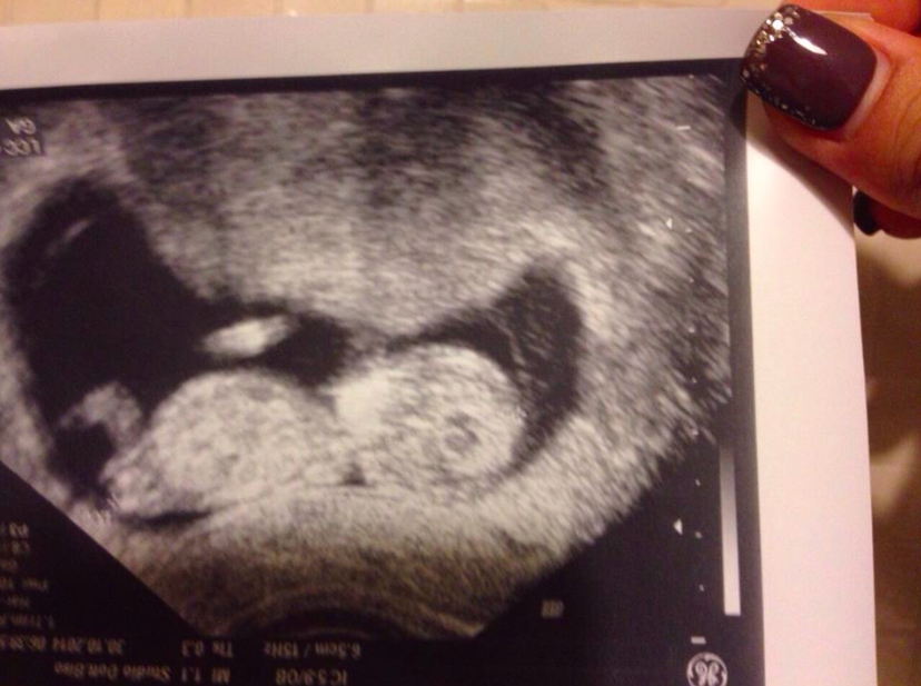 Uomini e Donne, l’ex corteggiatore Marco Gaggini sta per diventare papà: “E’ il regalo più grande che potessi desiderare!” preview