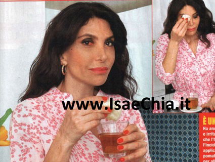 Carmen Di Pietro: “Ho rischiato di perdere un occhio, temevo di non vedere più i miei figli!” preview