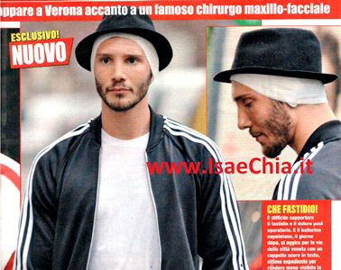 Stefano De Martino si fa ritoccare le orecchie. In famiglia c’è posto per una sola sventola, ed è Belén Rodriguez! article-post