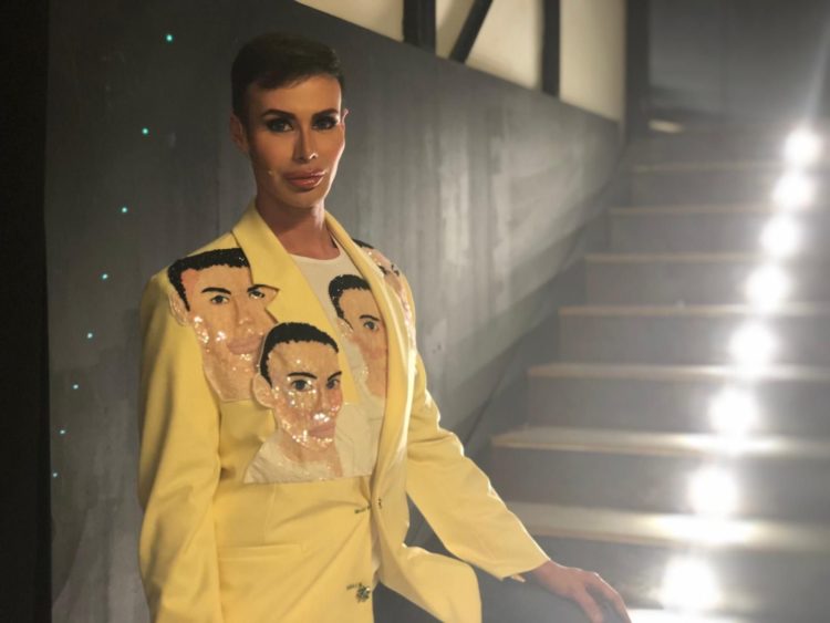 ‘Gf 15’, il Ken umano Angelo Sanzio rimuove il silicone dagli zigomi e a IsaeChia.it rivela: “Il chirurgo aveva trovato una massa terribile…” preview