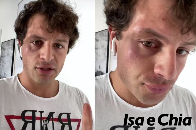 Iconize aggredito per strada dai bulli: ecco cosa è successo (Video) preview