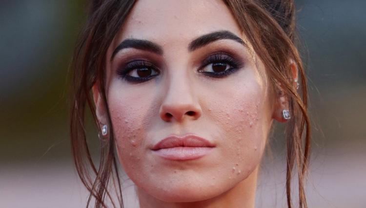 ‘Uomini e Donne’, Giulia De Lellis replica alle critiche dopo la scelta di skin positivity a ‘Venezia 77’ (video) preview