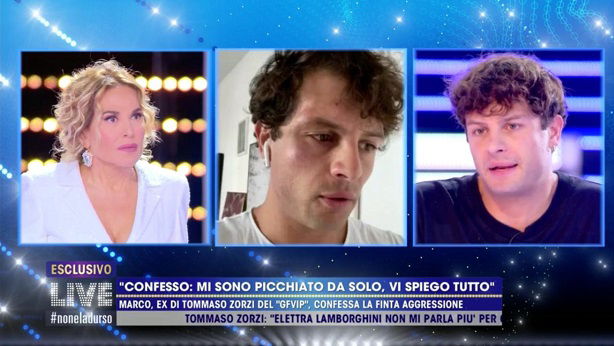 ‘Live – Non è la D’Urso’, Iconize svela (finalmente) tutta la verità dietro la finta aggressione omofoba preview