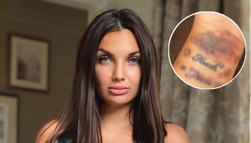 Elettra Lamborghini mostra il polso tumefatto sui social: ecco cosa le è successo preview