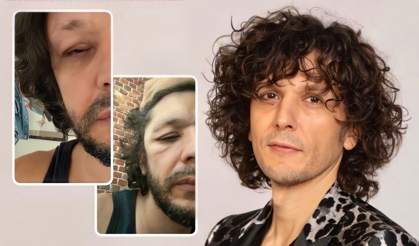 Ermal Meta rassicura i fan: “A leggere certi siti sembra che io stia morendo, ma…” preview