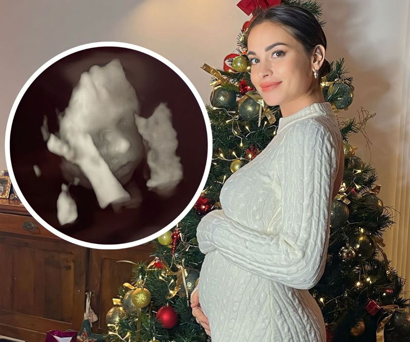 Uomini e Donne, Vittoria Deganello criticata per aver pubblicato il viso della figlia dall’ecografia: la sua replica preview