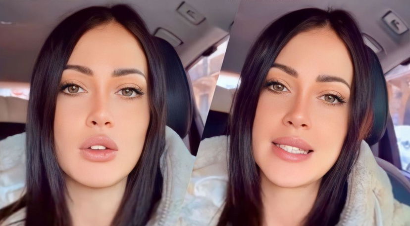 Uomini e Donne, Teresa Cilia si difende da chi l’attacca per aver fatto il filler e annuncia un nuovo intervento estetico preview