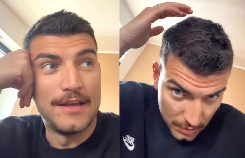 Uomini e Donne, nottata al Pronto Soccorso per Marco Fantini: “Ho tirato una capata contro la finestra e mi sono aperto la testa” preview