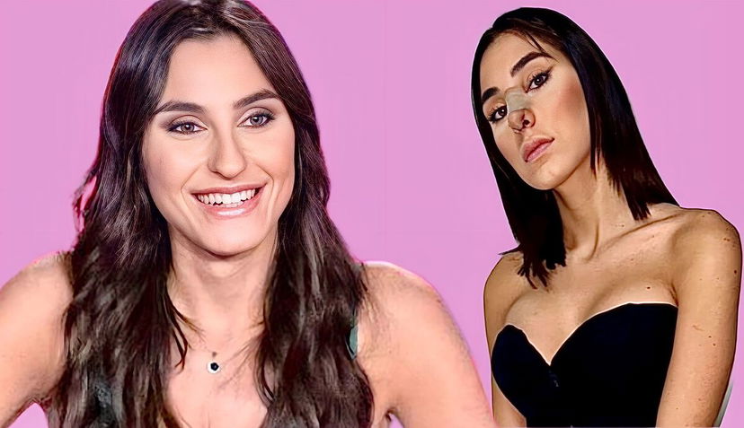 Temptation Island 10, Gabriela Chieffo mostra il prima e il dopo della rinoplastica: “Ecco come sarà il risultato finale” preview