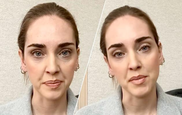 Chiara Ferragni in lacrime sui social dopo la multa dell’antitrust: “Ho sbagliato, voglio chiedere scusa e dare una concretezza a questo mio gesto” preview