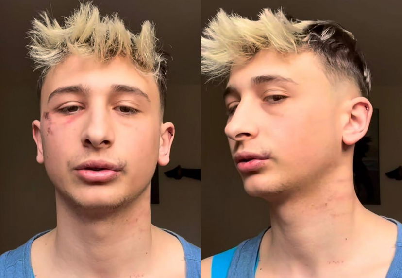 Gf Vip 7, George Ciupilan vittima di un’aggressione: “Scotto della popolarità, spero che…” preview