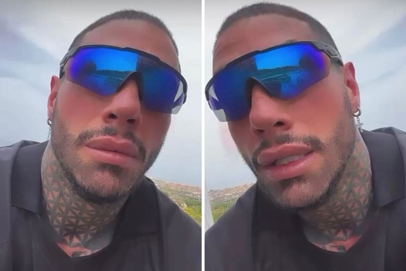 Temptation Island, Francesco Chiofalo si sfoga sui social e spiega per quale motivo non mostra il risultato dell’intervento agli occhi preview