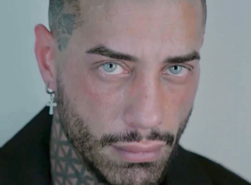 Temptation Island, Francesco Chiofalo svela: “Ecco il vero motivo che mi ha spinto a sottopormi all’intervento agli occhi!” preview