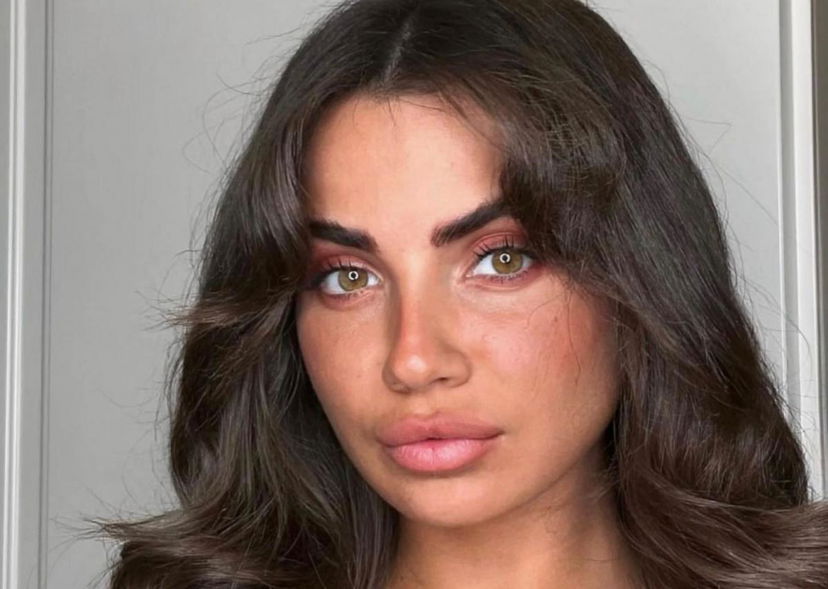 Eleonora Rocchini nella bufera dopo aver aperto una raccolta fondi per curare il suo cane: l’affondo della sua ex rivale a Uomini e Donne preview