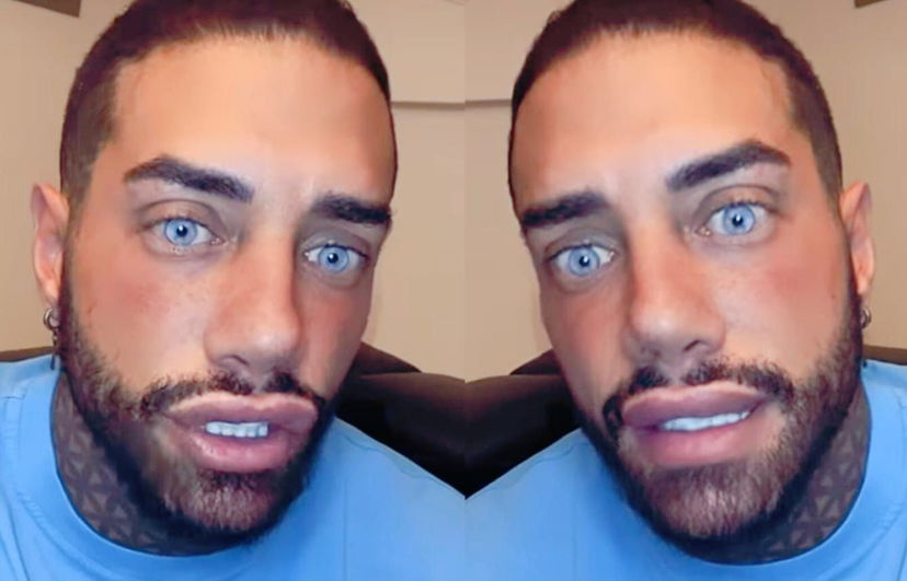 Francesco Chiofalo dopo l’intervento di cambio colore agli occhi: “Non posso più viaggiare fuori dall’Italia perché…” preview