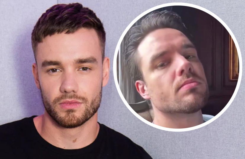 Liam Payne m0rto a 31 anni, il video caricato sui social un’ora prima di m0rire e la chiamata dell’hotel alla polizia: “Sta spaccando tutto” preview