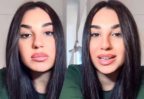 Uomini e Donne, Veronica Fedele ha rifatto il naso e si è mostrata sui social post operazione (Video) preview