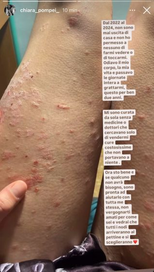 Instagram - Pompei