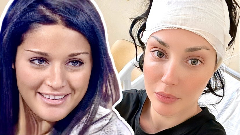 Uomini e Donne, Diletta Pagliano reduce da una delicata operazione alla testa: “Intervento di oltre 10 ore, due lesioni importanti”, come sta ora preview