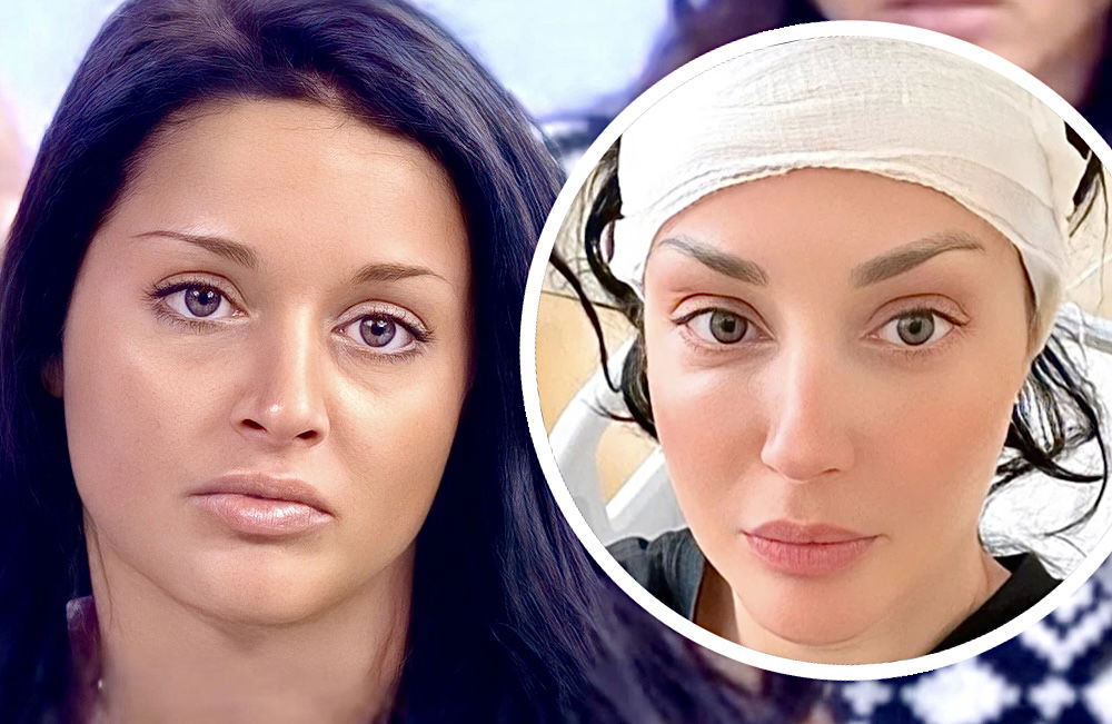Uomini e Donne, Diletta Pagliano mostra la ferita dopo la delicata operazione alla testa: “70 punti, hanno asportato tutto” article-post