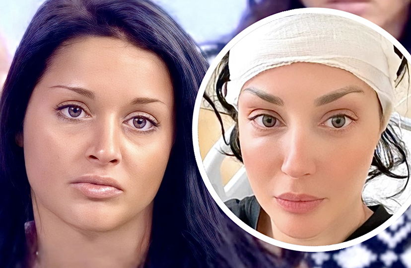 Uomini e Donne, Diletta Pagliano mostra la ferita dopo la delicata operazione alla testa: “70 punti, hanno asportato tutto” preview