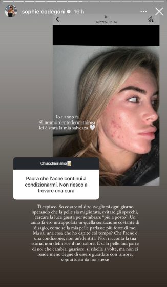 Instagram - Codegoni