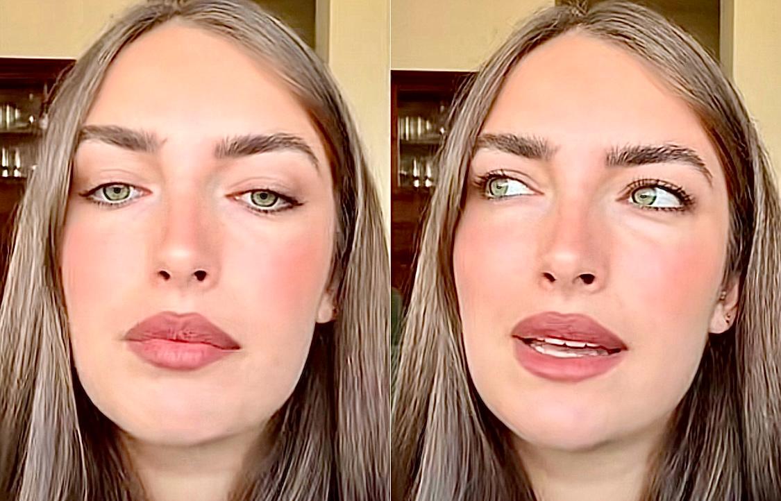 Nilufar Addati svela a quali interventi estetici si è sottoposta e commenta: “Perché il botox provoca questa reazione di sdegno?” article-post