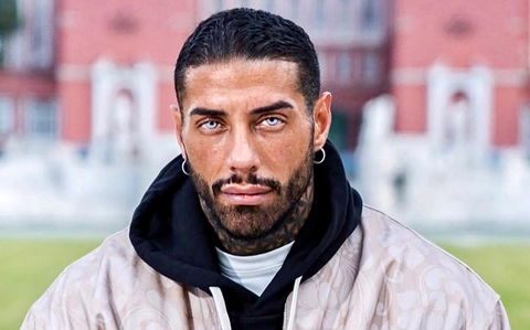 Francesco Chiofalo: “Insinuano che io abbia rifatto le labbra ma è l’unica cosa che non ho mai ritoccato, ecco perché” preview