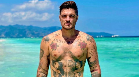 Grande Fratello, Luigi Mario Favoloso morso da un serpente marino velenoso mentre era in vacanza: com’è successo e come sta ora preview