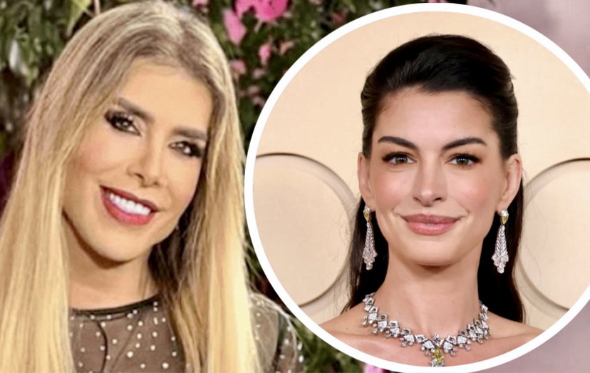 Genny Urtis svela a quali ritocchini si sarebbe sottoposta Anne Hathaway preview