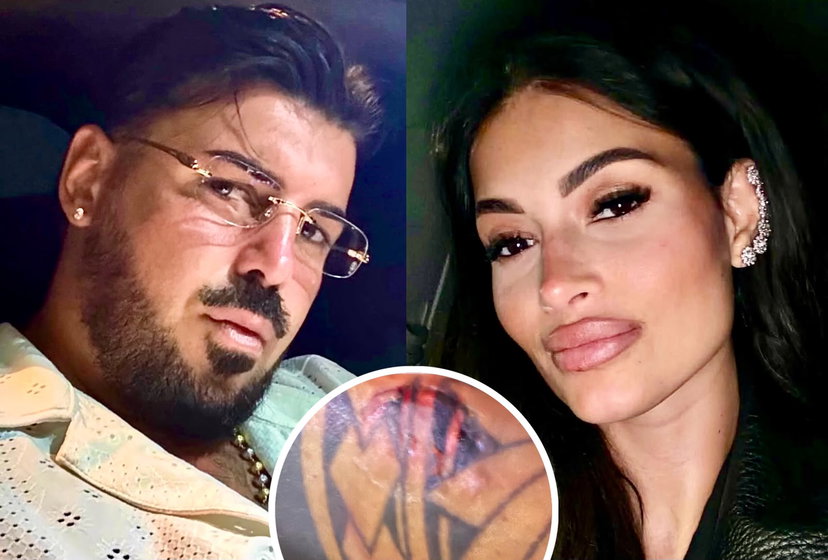 Lino Giuliano pubblica una foto choc e poi la cancella: “Alessia Pascarella mi ha aggredito, la nostra storia è finita!” preview