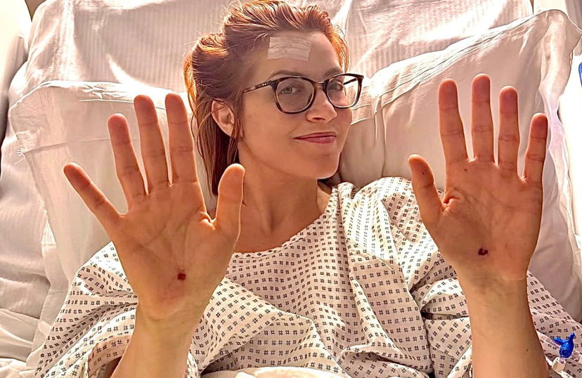 Noemi mostra sui social le ferite dopo la brutta caduta dal palco e ironizza: “Canta che ti passa”, come sta ora preview