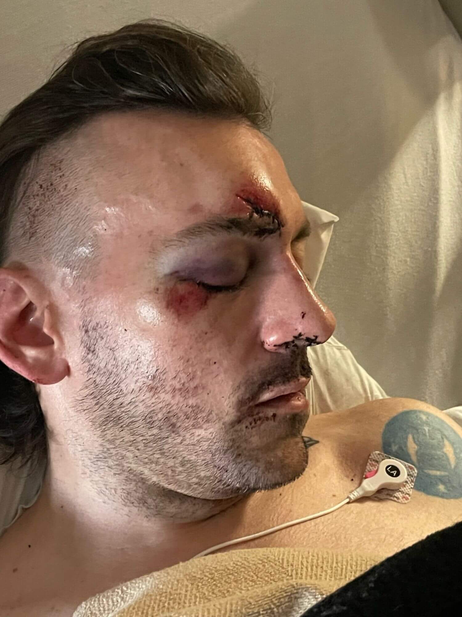 Le condizioni di Donny Cates dopo l'incidente