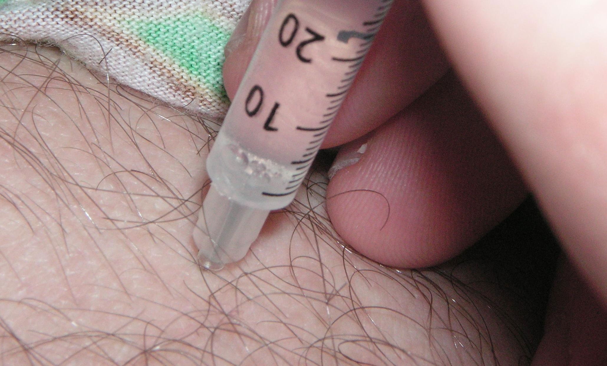 ebola vaccinazioni
